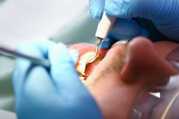 Best Urgent Care for Lost Fillings or Crowns in Columbia, PA