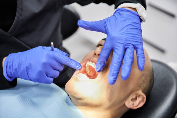 Best Emergency Treatment for Dental Infections or Abscesses in Columbia, PA